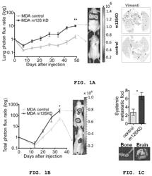 Treatment of angiogenesis disorders