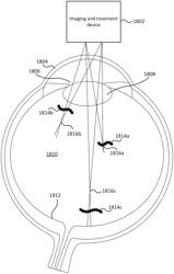 SYSTEM AND METHOD FOR DETECTION OF FLOATERS