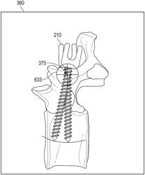 Systems and methods for simulating three-dimensional orientations of surgical hardware devices about an insertion point of an anatomy