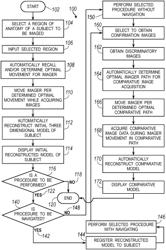 Selected image acquisition technique to optimize specific patient model reconstruction