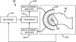 System and method for controlling focused ultrasound treatment