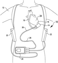 Systems and methods for inertial sensing for VAD diagnostics and closed loop control