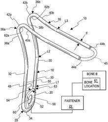 METHOD AND APPARATUS FOR MAINTAINING A POSITION OF A BONE FRAGMENT IN RELATIONSHIP TO ANOTHER BONE PART