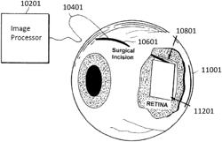 ADVANCED EAR ACCESS