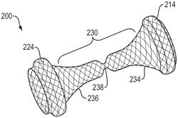 FLOW CONTROL STENT