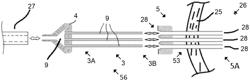 Free scar instrument and method