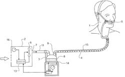 BREATHING ASSISTANCE APPARATUS