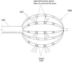 Systems and methods for optical interrogation of ablation lesions