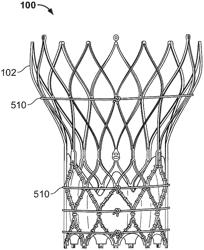 Valve assembly method for crimp profile