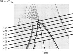 Method of and apparatus for creating an all-in-focus image of a portion of an iridocorneal angle of an eye