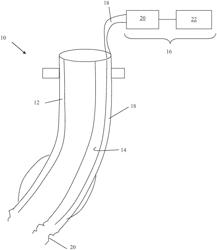 NON-OCCLUDED DUAL LUMEN ENDOTRACHEAL TUBE