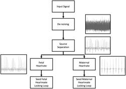 FETAL MAGNETOCARDIOGRAPHY SYSTEMS AND METHODS