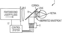 Vision correction with laser refractive index changes