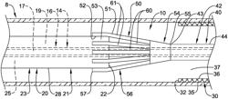 Stent delivery systems