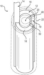 Devices and related methods for gastrectomies