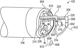 INTRAUTERINE MORCELLATION DEVICE