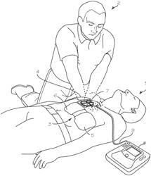 Compression Depth Monitor With Variable Release Velocity Feedback