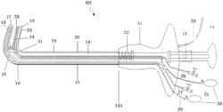 Chemical ablation apparatus for treating arrhythmia