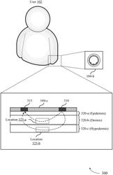 TECHNIQUES FOR DETERMINING BLOOD PRESSURE BASED ON MORPHOLOGICAL FEATURES OF PULSES