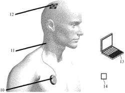 SYSTEM FOR SENSING EEG SIGNALS ON A LIVING BEING, AND SYSTEM FOR ELECTRICALLY STIMULATING TISSUE OF A LIVING BEING