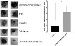 COMBINATION TREATMENT FOR ANTIBIOTIC RESISTANT INFECTIONS