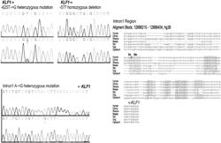 A METHOD FOR IN VIVO GENE THERAPY TO CURE SCD WITHOUT MYELOABLATIVE TOXICITY