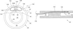 Endovascular devices and methods for exploiting intramural space