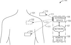 INDIVIDUALIZED HEART FAILURE DIAGNOSTIC BASED ON COMORBIDITIES