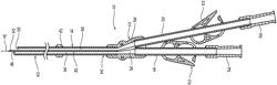 CATHETER POSITIONING