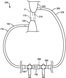 SHEATHS INCLUDING INBUILT MALE LUER CONNECTORS