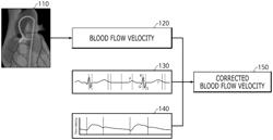 METHOD AND APPARATUS FOR CALIBRATING BLOOD FLOW VELOCITY