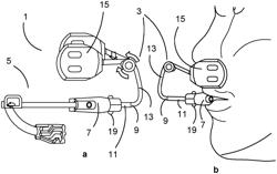 Adjustment means for a mandibular advancement device