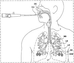 METHODS, APPARATUSES, AND SYSTEMS FOR THE TREATMENT OF DISEASE STATES AND DISORDERS