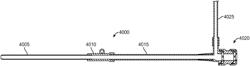 Systems and methods for treating a carotid artery