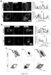 TDP-43 mitochondrial localization inhibitor for the treatment of neurogenerative disease