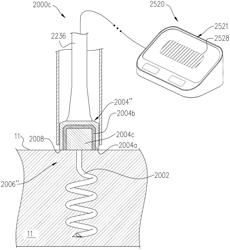 BIOELECTRICAL GUIDANCE FOR ANCHORING