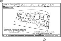 SYSTEMS FOR VISUALIZING TEETH AND TREATMENT PLANNING