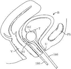 Apparatus and methods to modulate bladder function