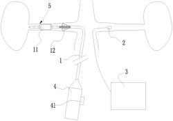 PREOPERATIVE DETECTION METHOD AND A POSTOPERATIVE DETECTION METHOD FOR NEUROMAPPING