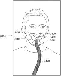 PATIENT INTERFACE WITH MOUTH CLOSURE STRUCTURE