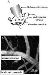 BIOCOMPATIBLE IMAGING PARTICLES, THEIR SYNTHESIS AND USE IN IMAGING TECHNIQUES