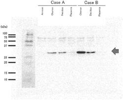 TESTING METHOD AND TESTING REAGENT