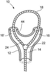 DEVICE, SYSTEM AND METHOD FOR TREATMENT OF HEMORRHOIDS