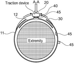 ORTHOPAEDIC DEVICE