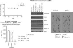 METHODS AND COMPOSITIONS FOR TREATING CANCER