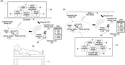 Apparatus for correcting posture of ultrasound scanner for artificial intelligence-type ultrasound self-diagnosis using augmented reality glasses, and remote medical diagnosis method using same