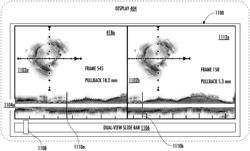 ALIGNMENT FOR MULTIPLE SERIES OF INTRAVASCULAR IMAGES