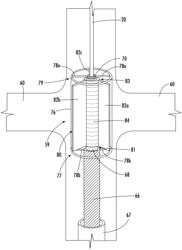 RENAL PUMP SUPPORT SYSTEM