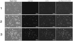 Screening Method Using Brown Adipocytes