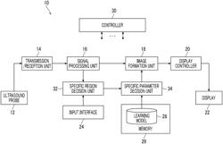 ULTRASOUND DIAGNOSTIC APPARATUS